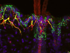 microscopic image of stained proteins on neurons involved in itch
