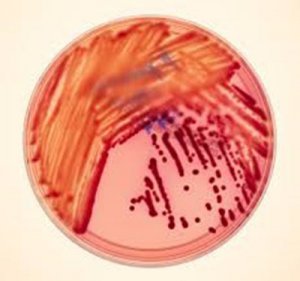 carbapenem-resistant Klebsiella pneumoniae in petri dish