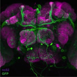 micrograph stained tissue: superset of GFP-labeled sleep-promoting  neurons in the brain of Drosophila melanogaster
