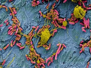 high resolution micrograph of pathogenic bacteria binding to tissue