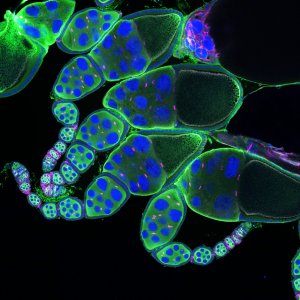 microscope image of Drosophila ovary tissue