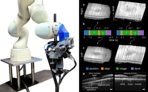 A robotic arm with 3D images of an eye under surgery
