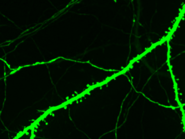 Neuron Image