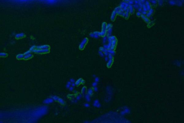 microscopic image of lumen