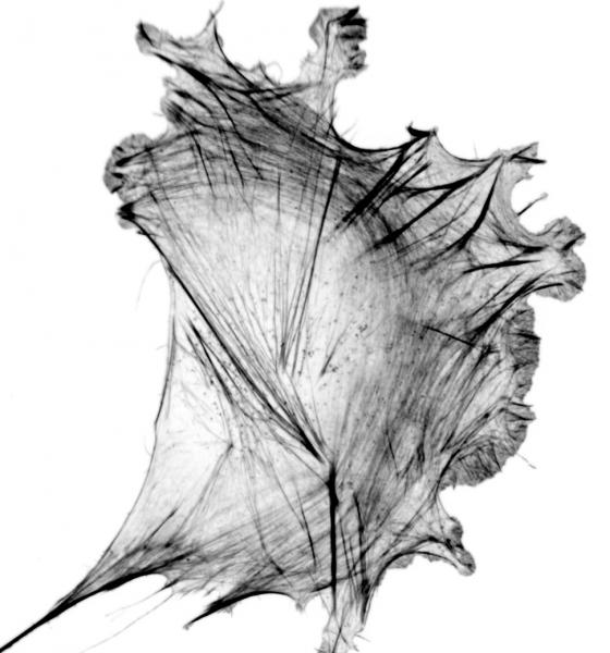 microscope image of actin