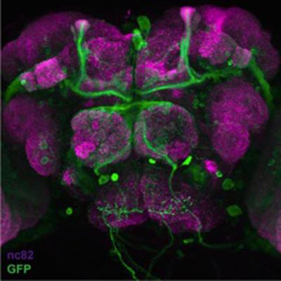 micrograph stained tissue: superset of GFP-labeled sleep-promoting  neurons in the brain of Drosophila melanogaster