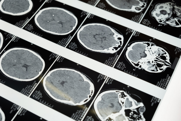 AI for Medical Imaging cover image