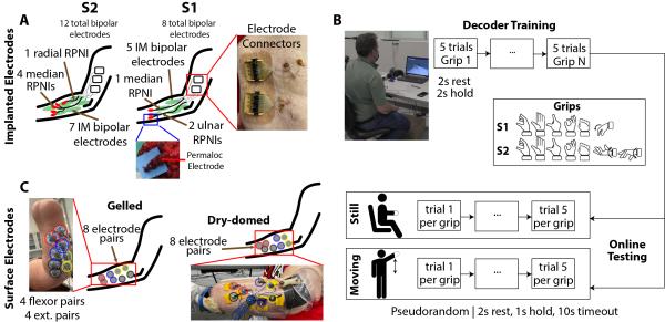 diagram of electrode placements for neuroprosthetic control