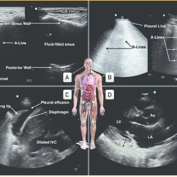 Researchgate: Point of Care Ultrasound (POCUS)